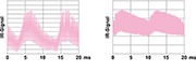 Bild 1: Links: Infrarot-Signal einer Leuchtstofflampe mit niedriger Modulation. Rechts: IR-Signal einer Leuchtstofflampe mit hoher Modulation Bild 1: Links: Infrarot-Signal einer Leuchtstofflampe mit niedriger Modulation. Rechts: IR-Signal einer Leuchtstofflampe mit hoher Modulation